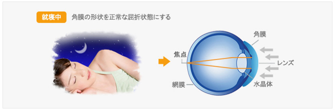 オルソケラトロジーの仕組み02